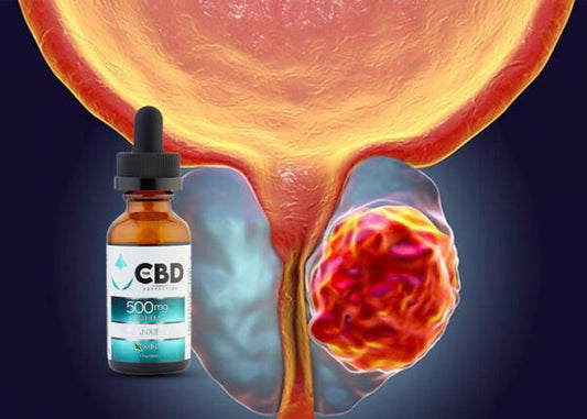 CBD y beneficios para el tratamiento de cáncer de próstata